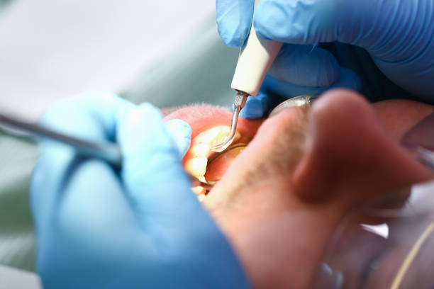 Best Urgent Dental Care for Toothache in Crystal Lawns, IL