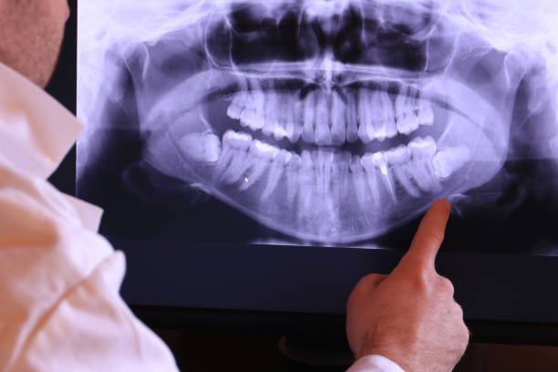 Best Weekend Emergency Dentist in Crystal Lawns, IL