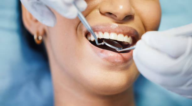 Best Emergency Dentist for Lost Fillings or Crowns in Crystal Lawns, IL