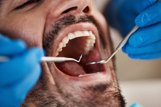 Best Mobile Emergency Dentist in Crystal Lawns, IL