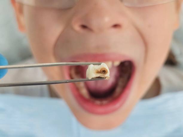 Best Emergency Dental Services for Seniors in Crystal Lawns, IL